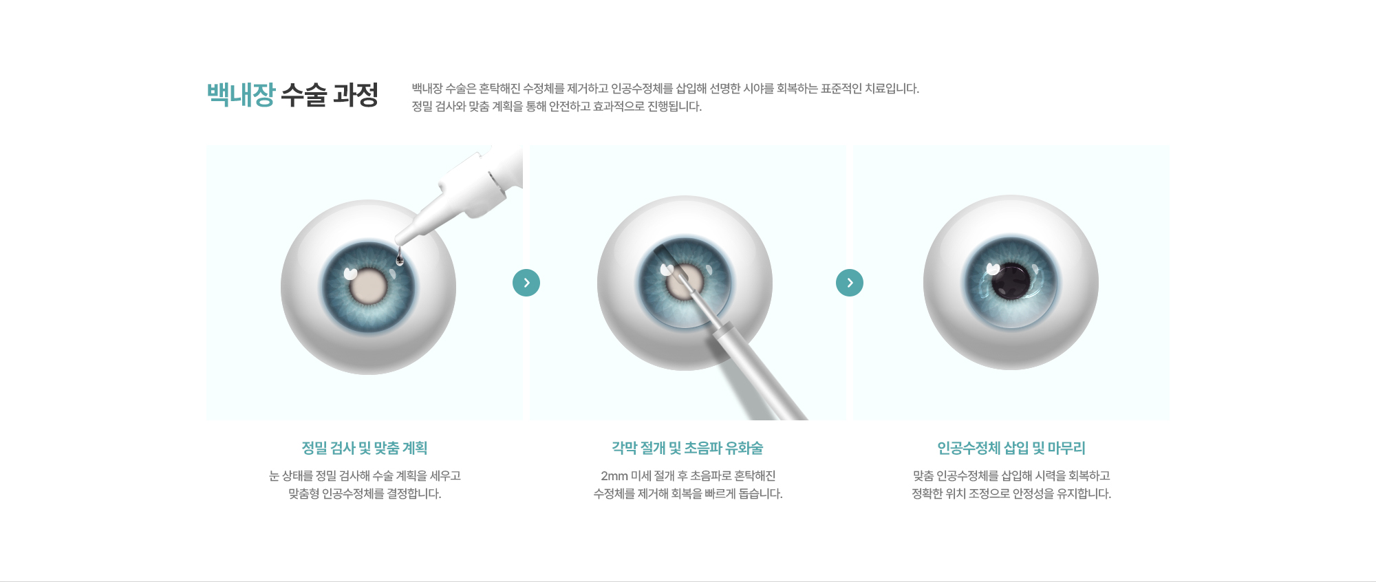 [백내장 수술 과정] 백내장 수술은 혼탁해진 수정체를 제거하고 인공수정체를 삽입해 선명한 시야를 회복하는 표준적인 치료입니다. 정밀 검사와 맞춤 계획을 통해 안전하고 효과적으로 진행됩니다.